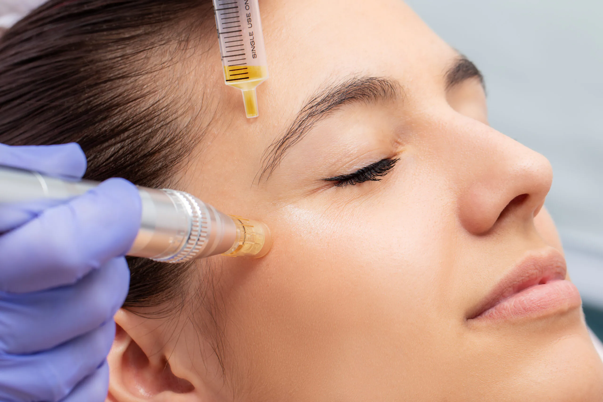 Reduce Crow’s Feet