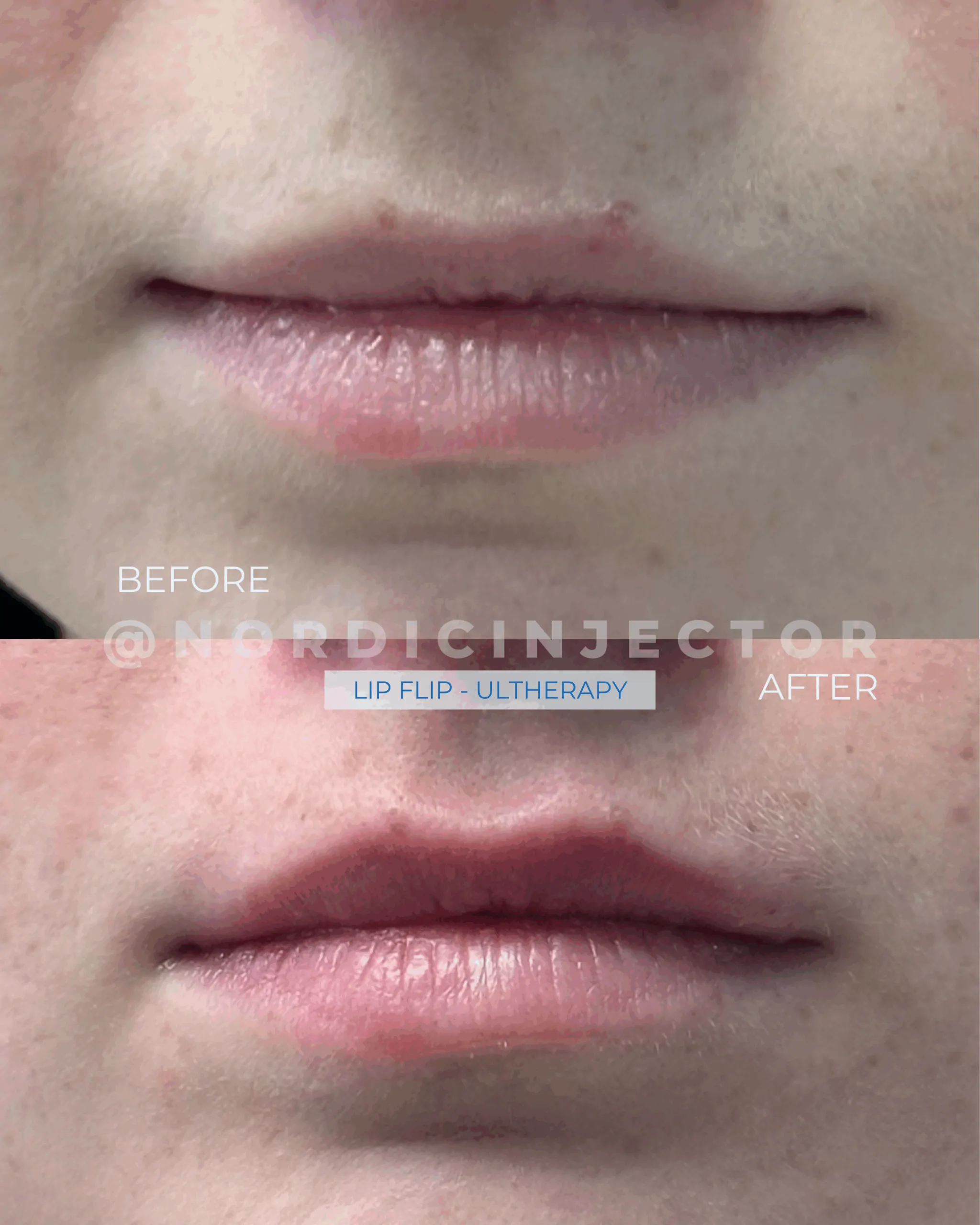 before and after (1080 x 1350 px).zip - 13