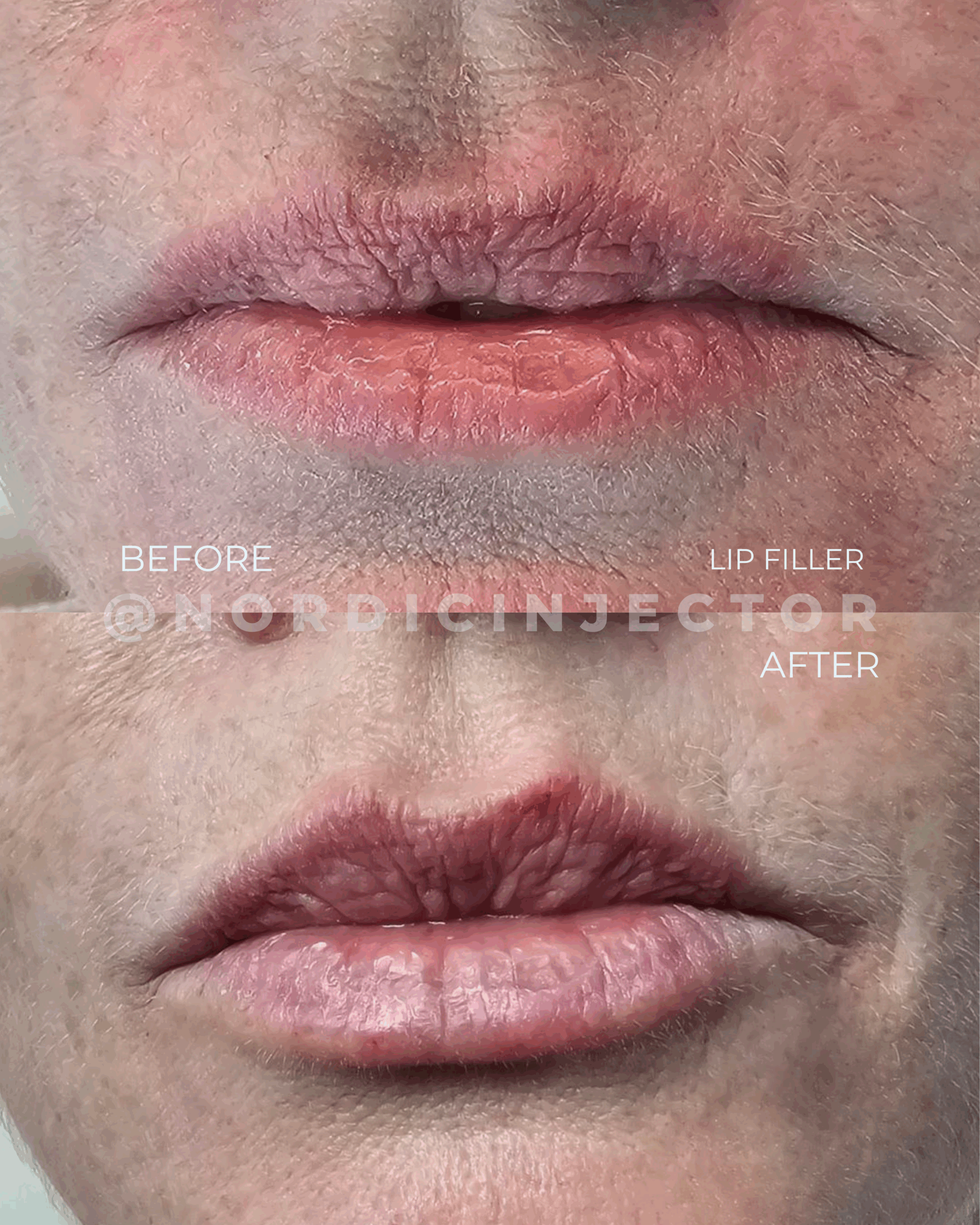 before and after (1080 x 1350 px).zip - 14