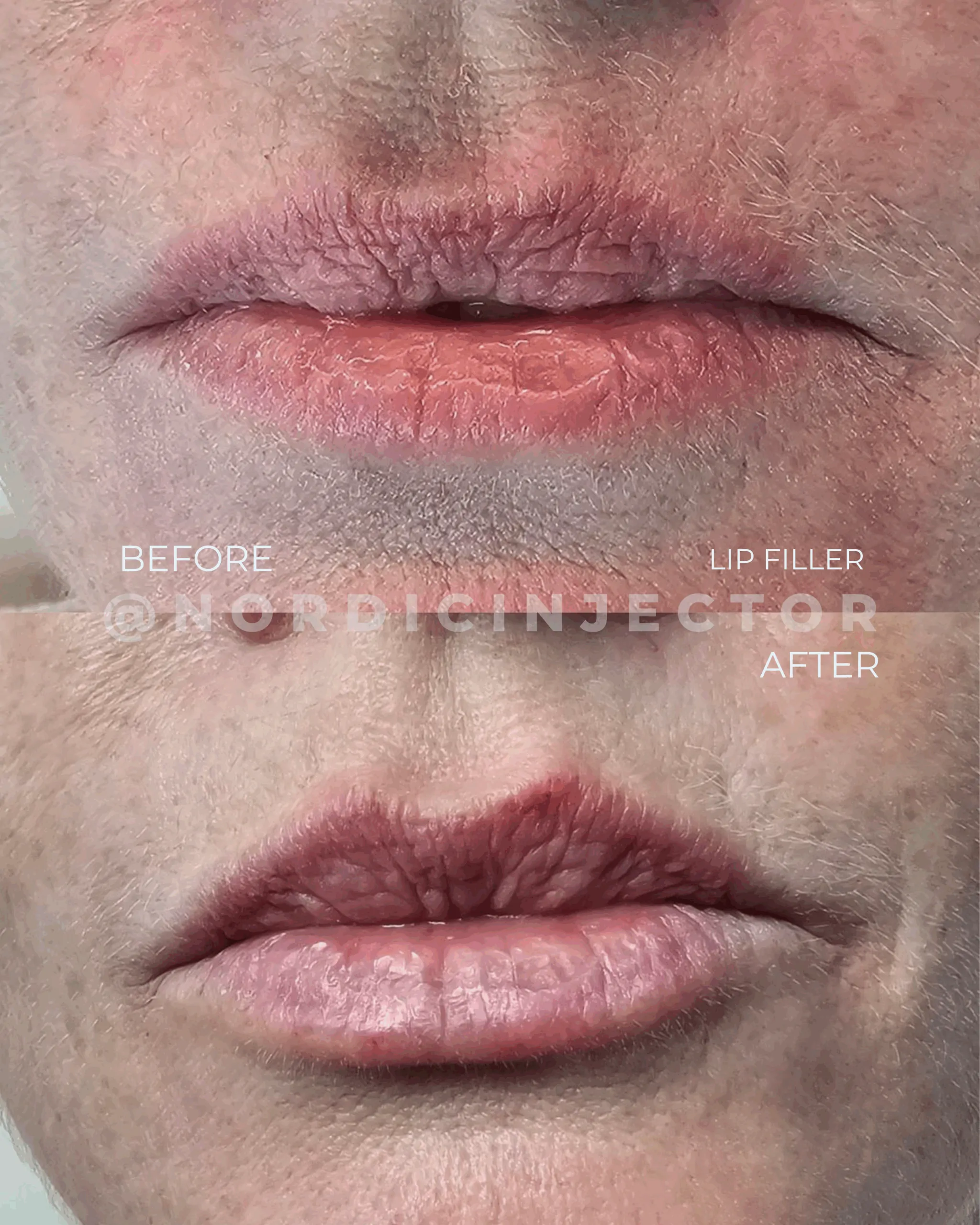 before and after (1080 x 1350 px).zip - 14