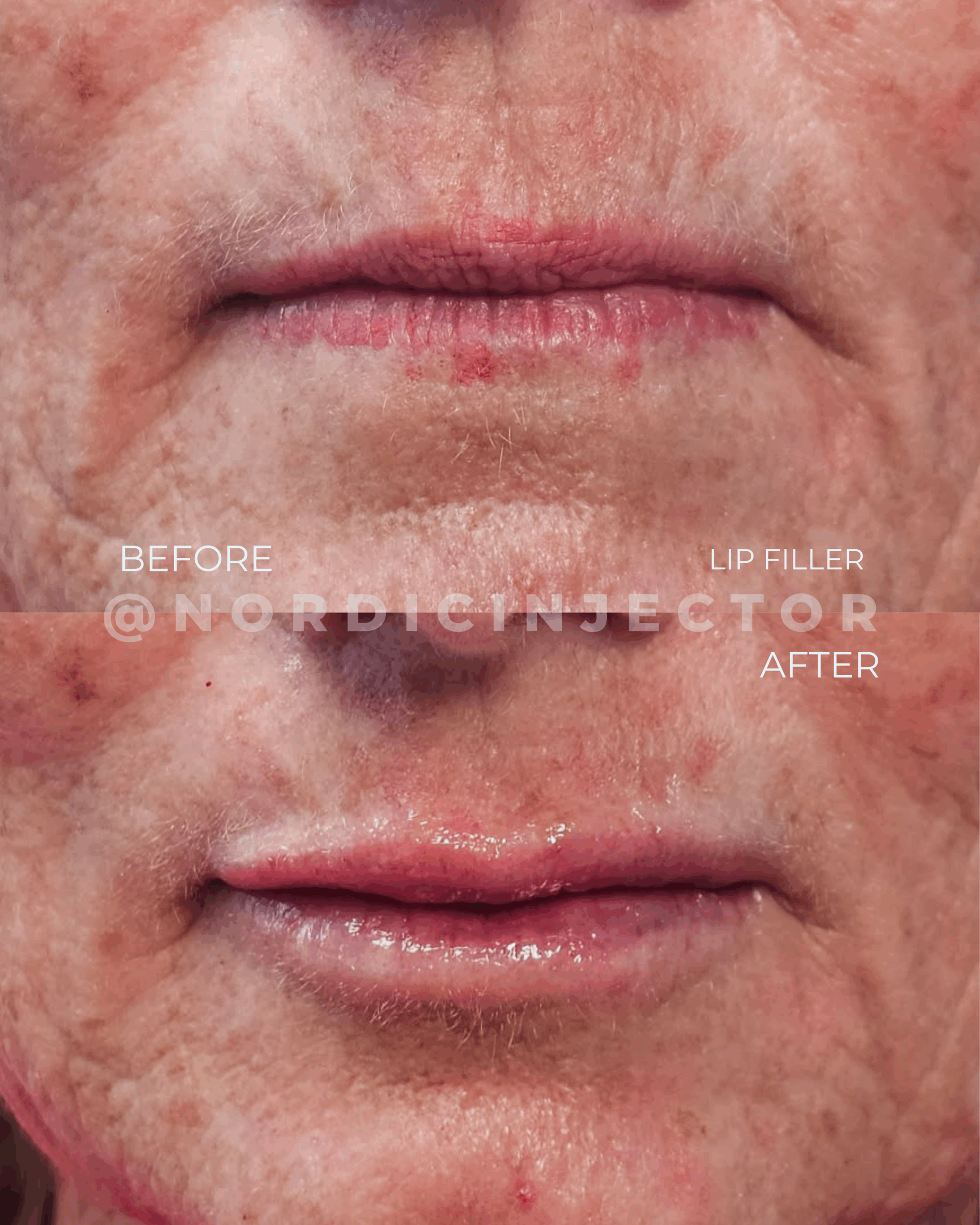 before and after (1080 x 1350 px).zip - 15