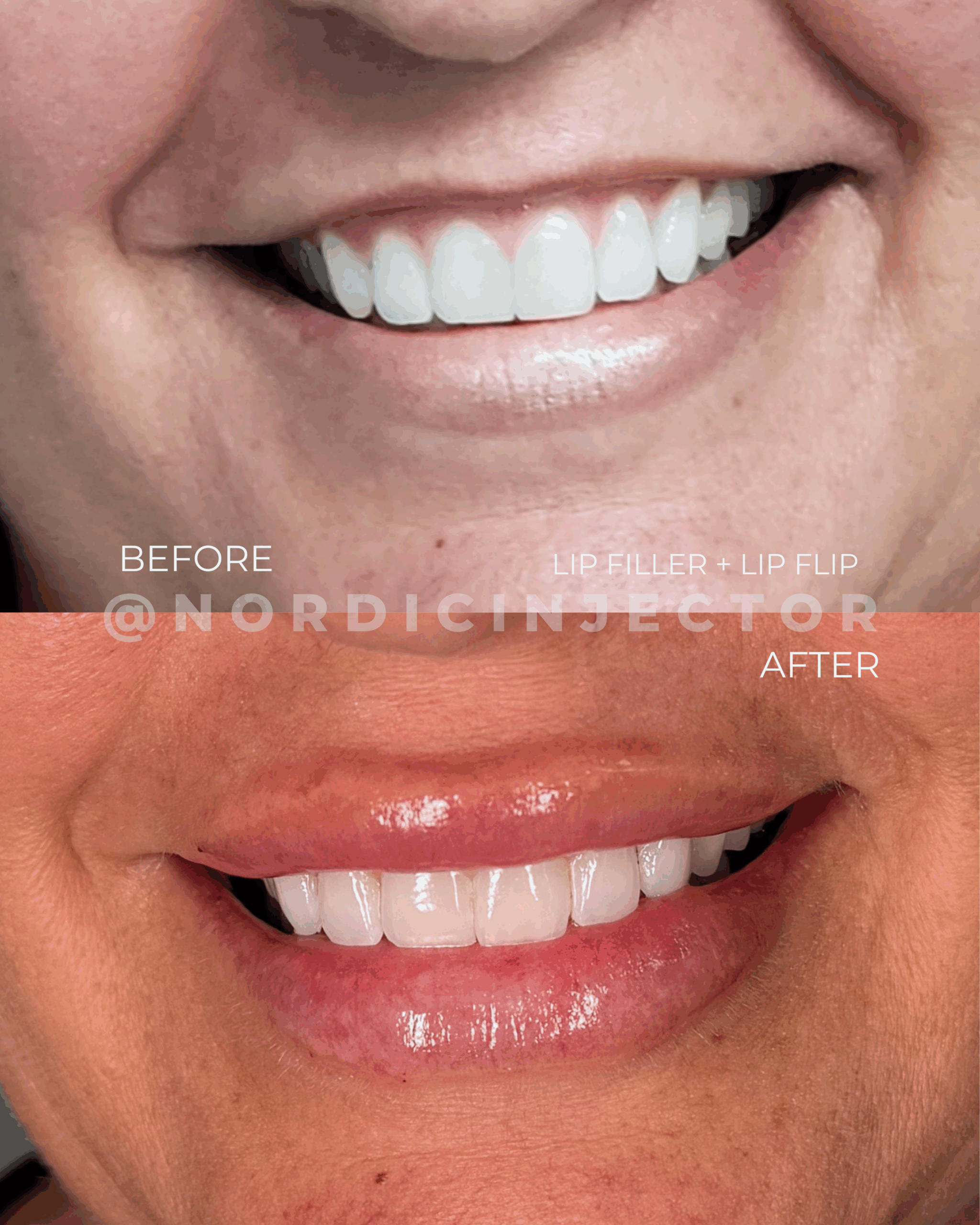 before and after (1080 x 1350 px).zip - 16