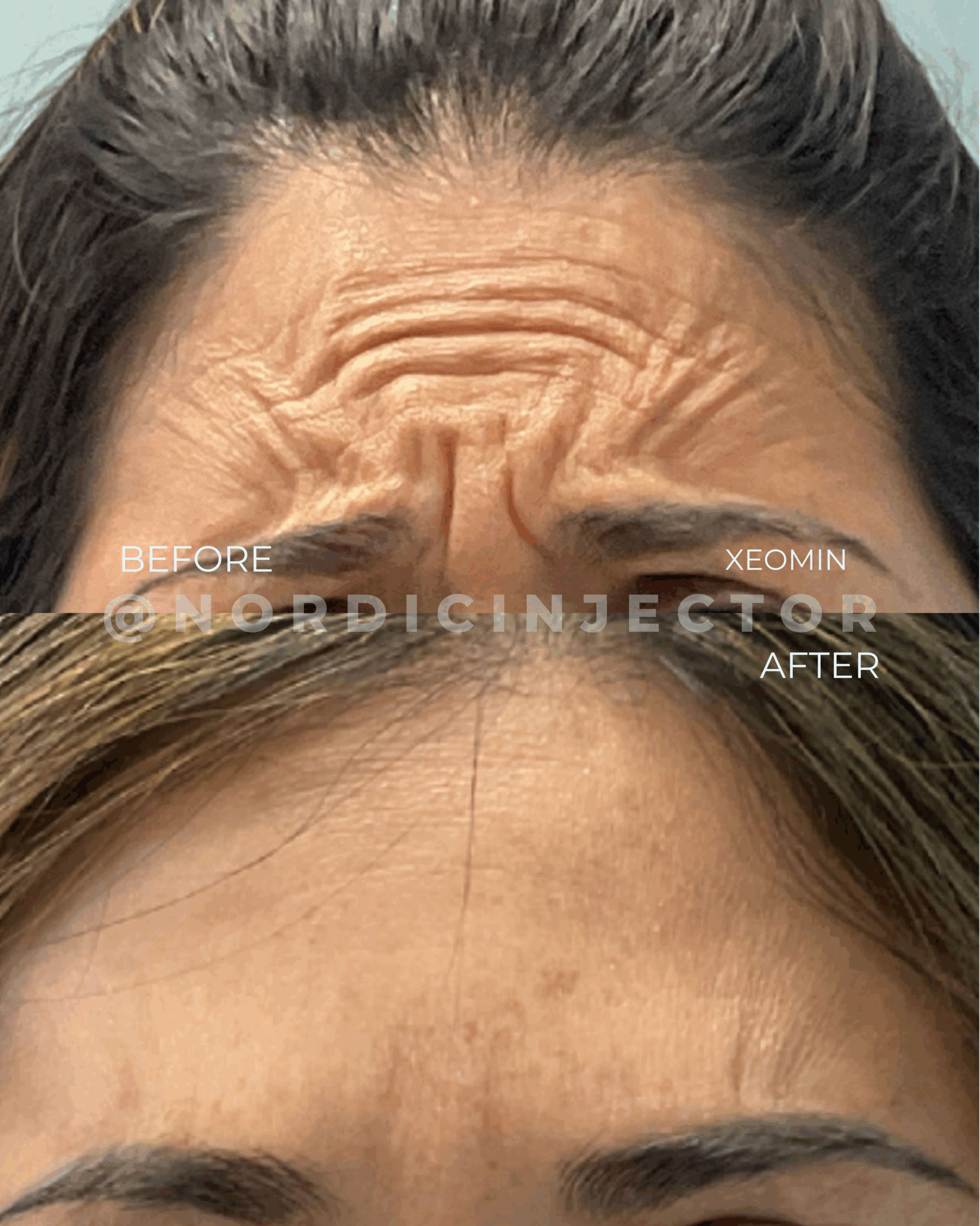 before and after (1080 x 1350 px).zip - 17