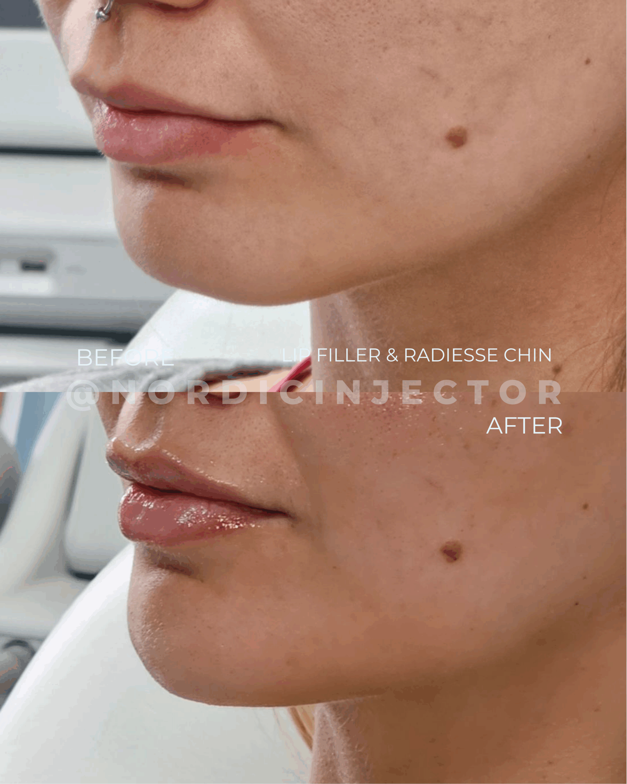 before and after (1080 x 1350 px).zip - 18