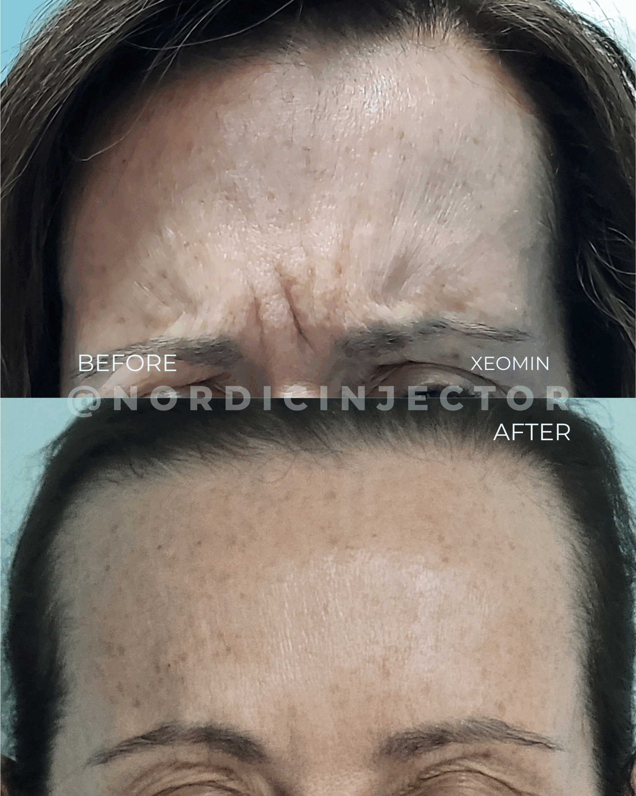 before and after (1080 x 1350 px).zip - 31