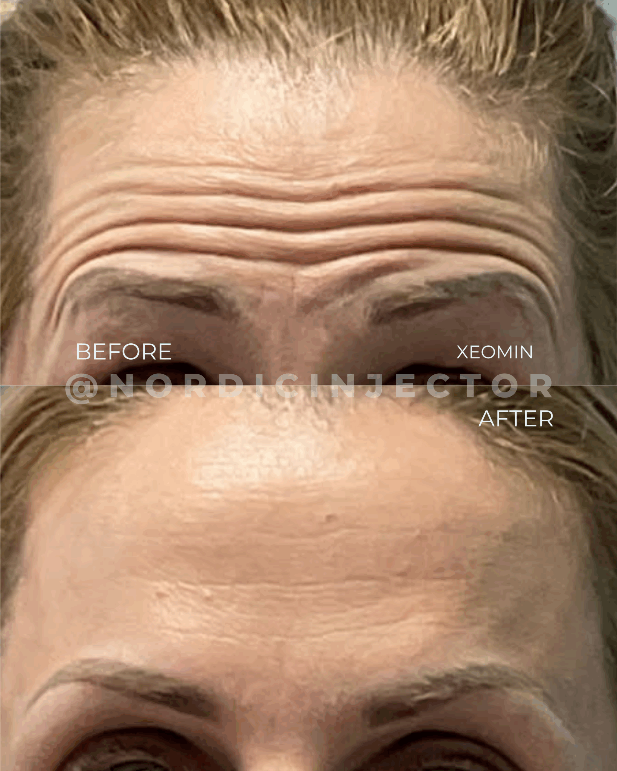 before and after (1080 x 1350 px).zip - 32