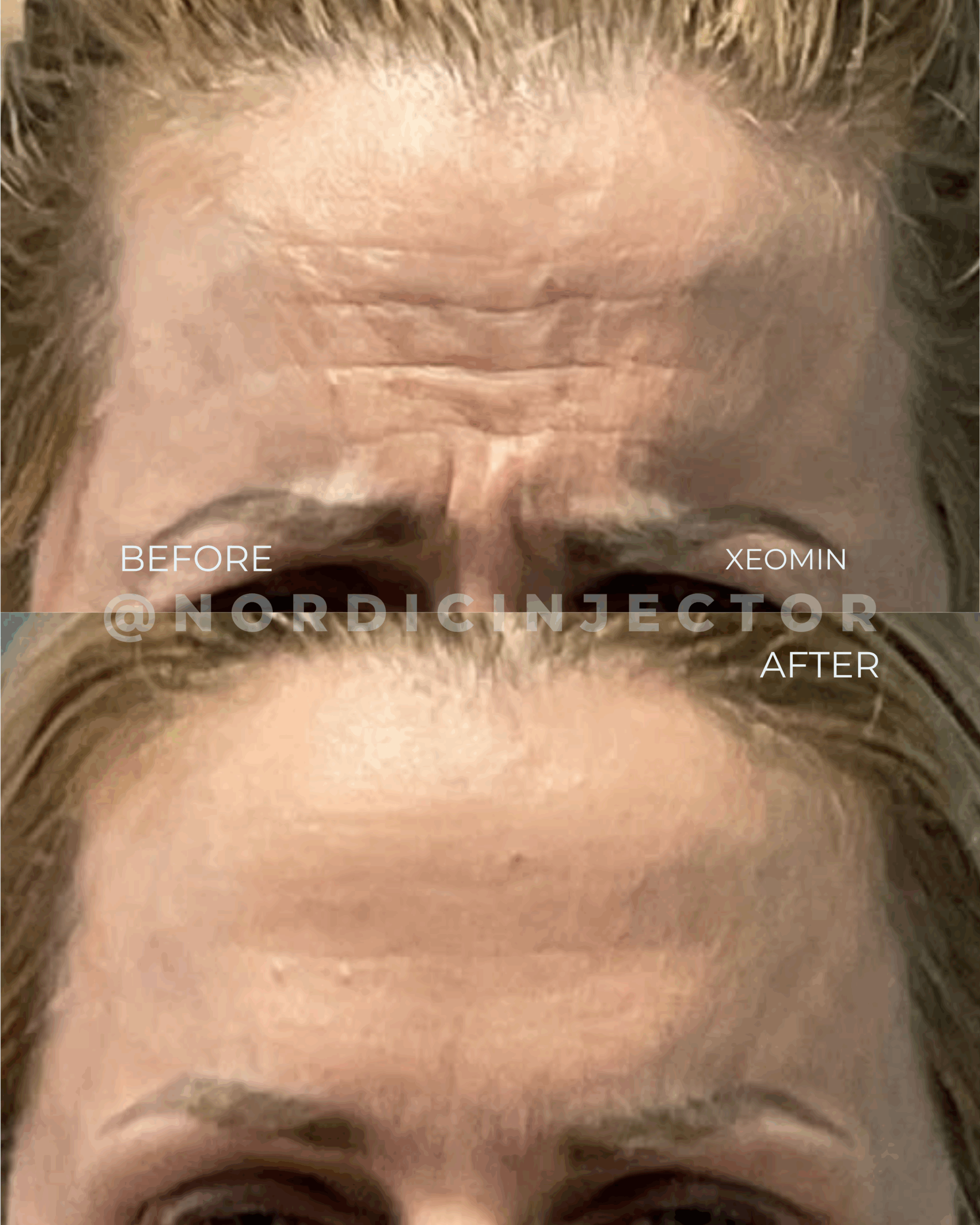 before and after (1080 x 1350 px).zip - 33