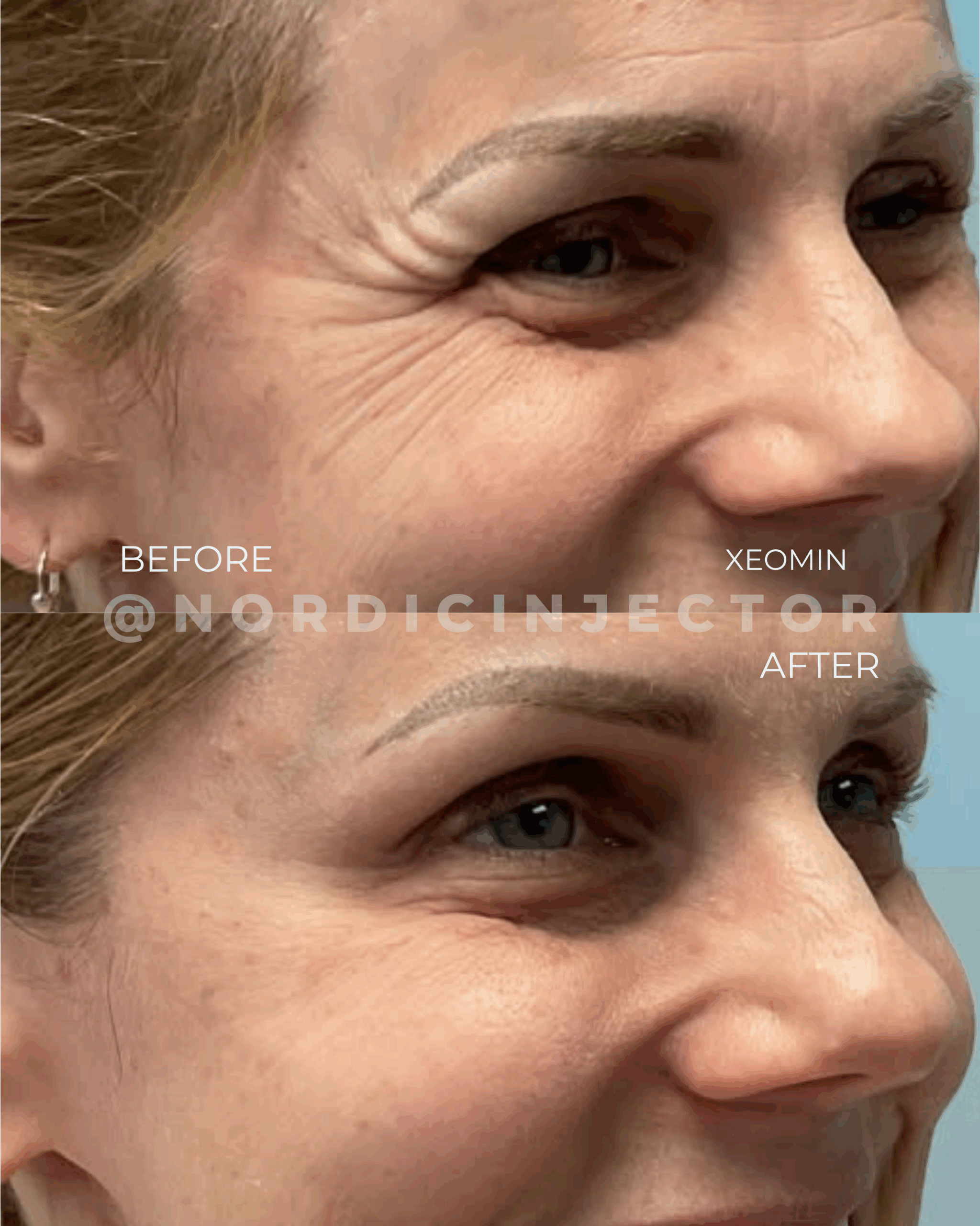 before and after (1080 x 1350 px).zip - 34