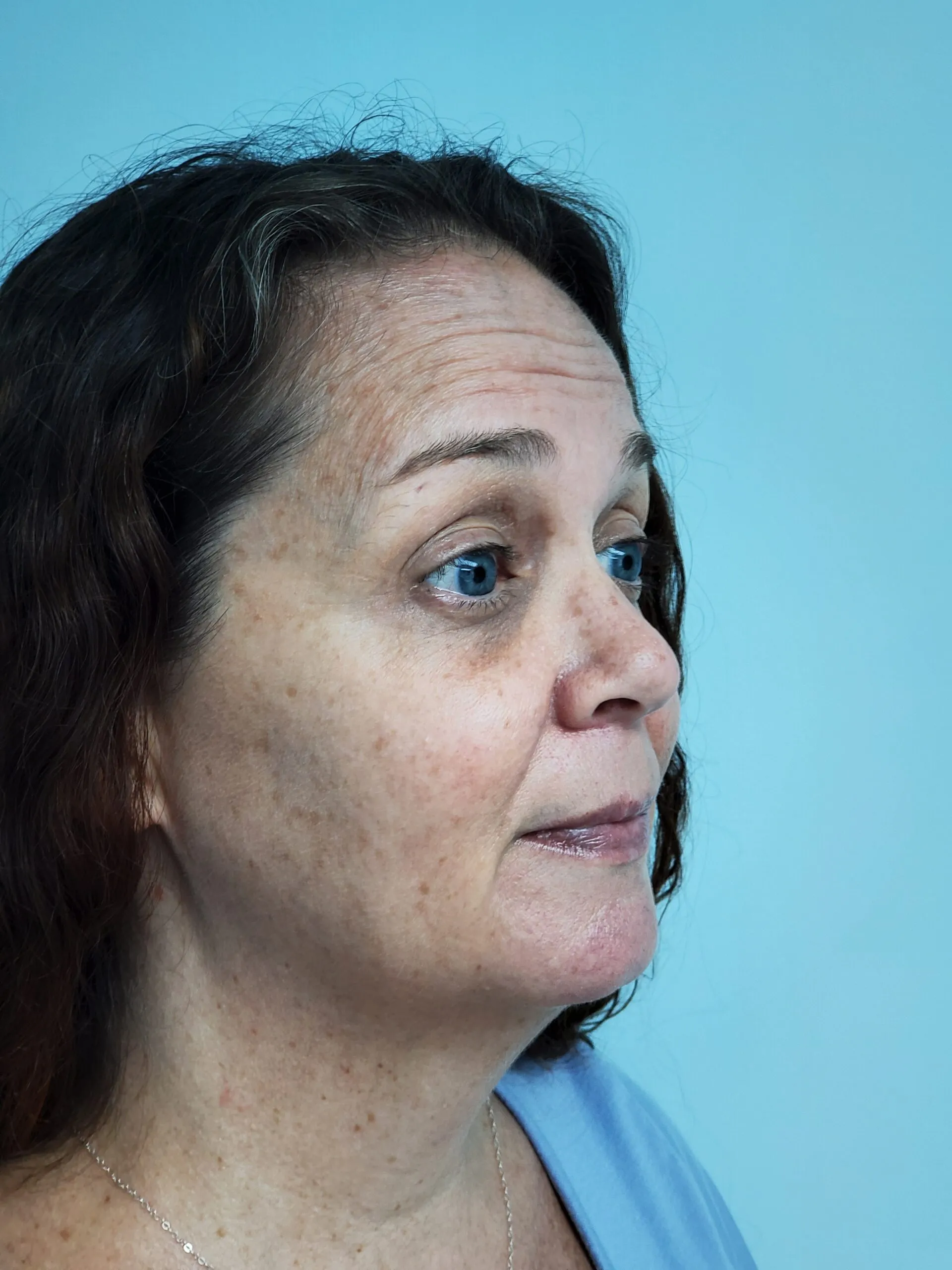 face-it-gallery-ba-carousel11b-scaled-2