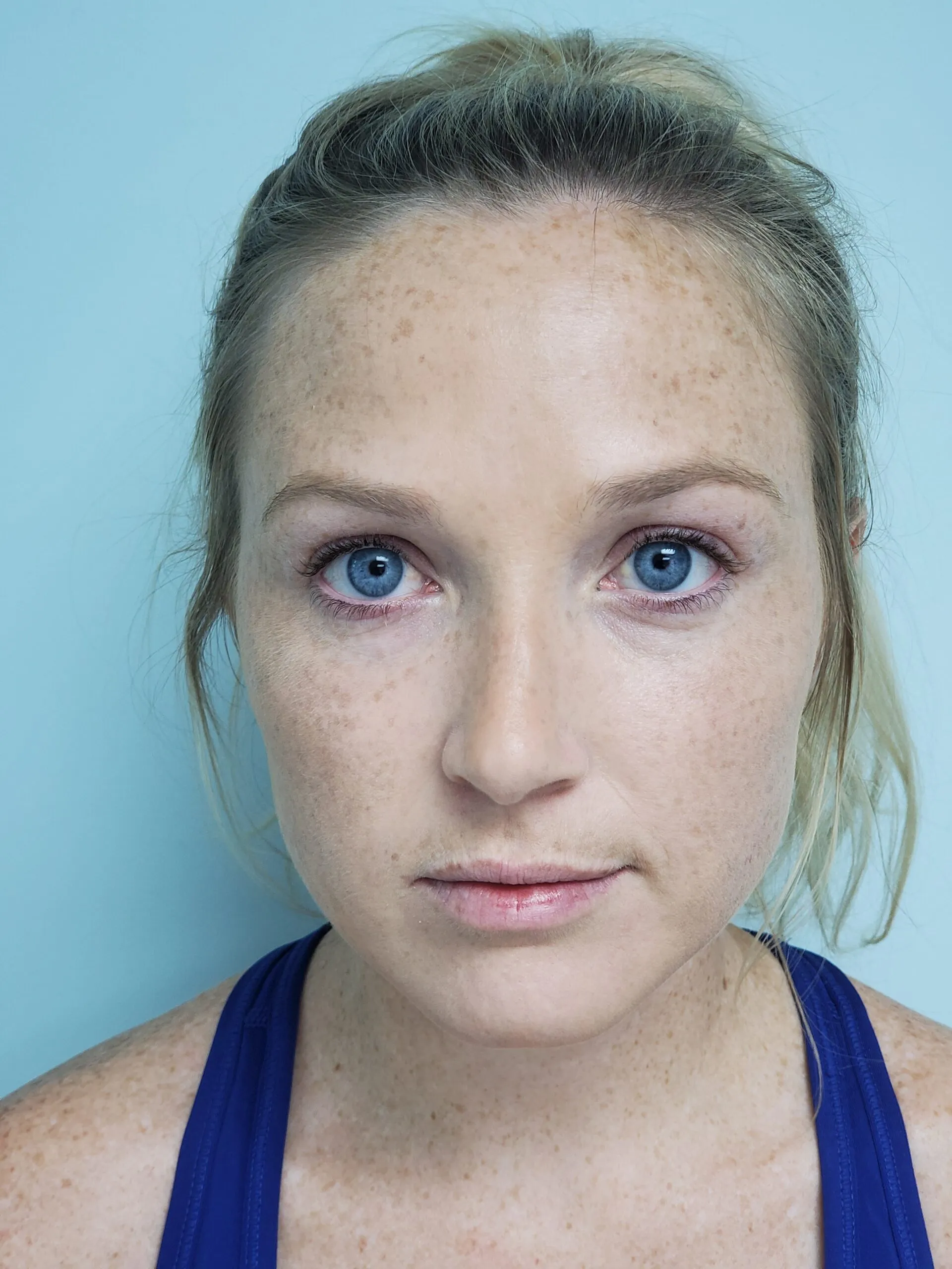 face-it-gallery-ba-carousel2a-scaled-1