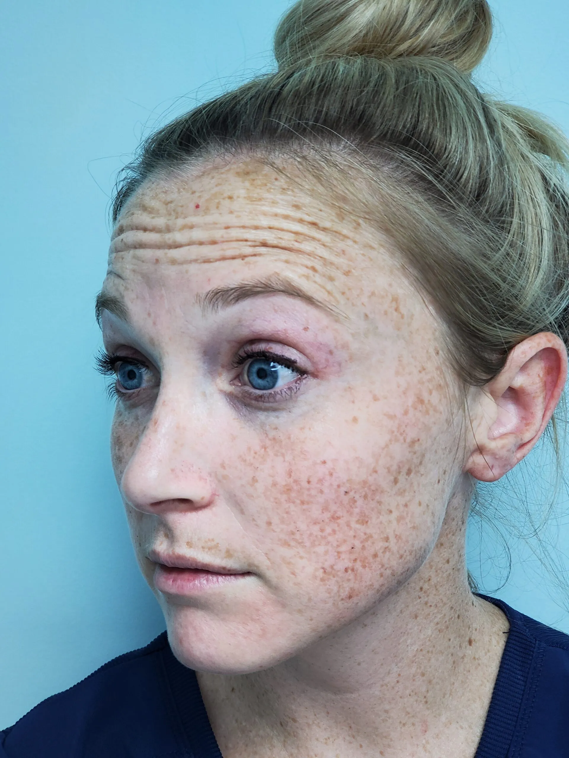 face-it-gallery-ba-carousel3b-scaled-2