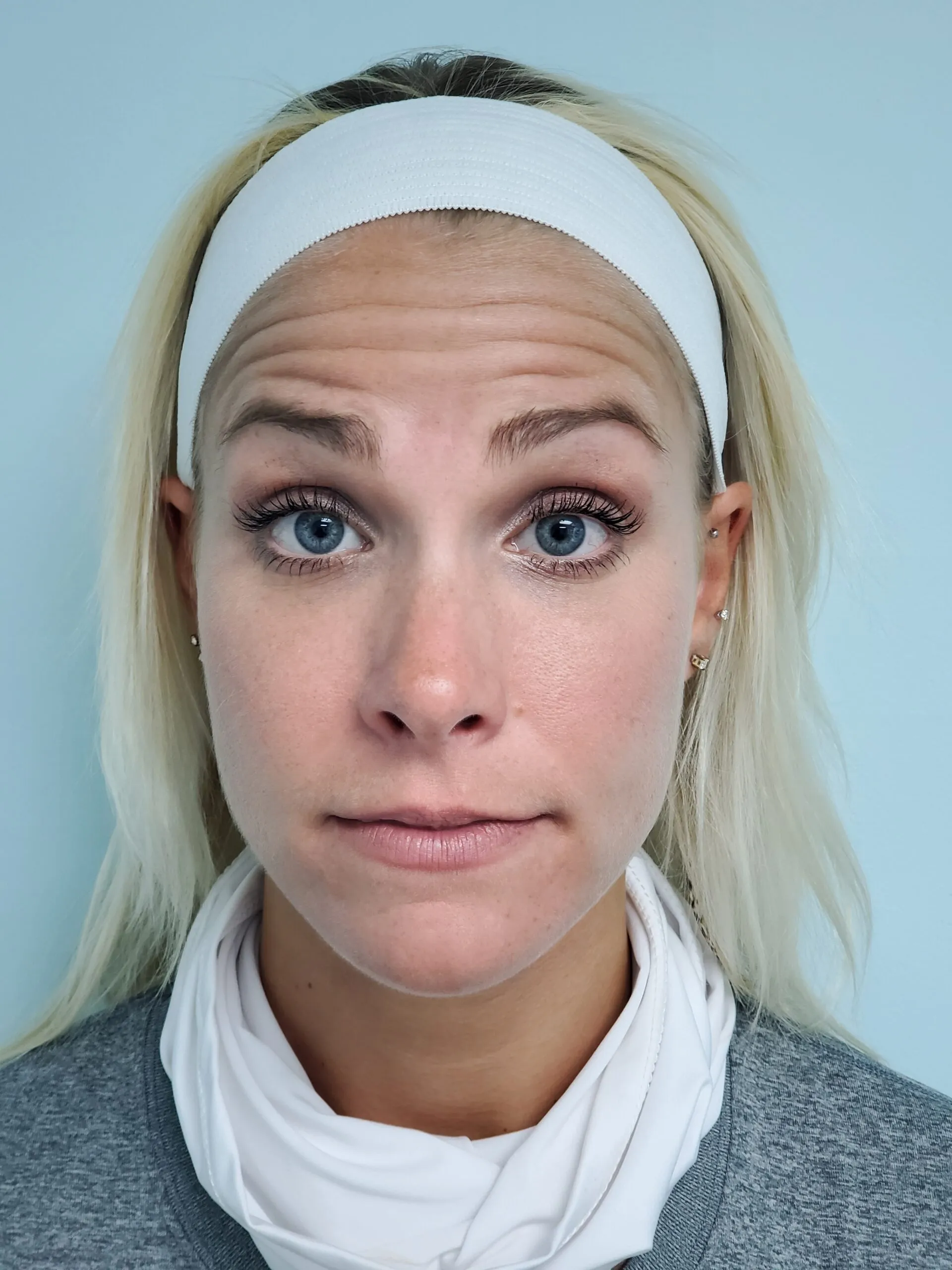 face-it-gallery-ba-carousel5b-scaled-2