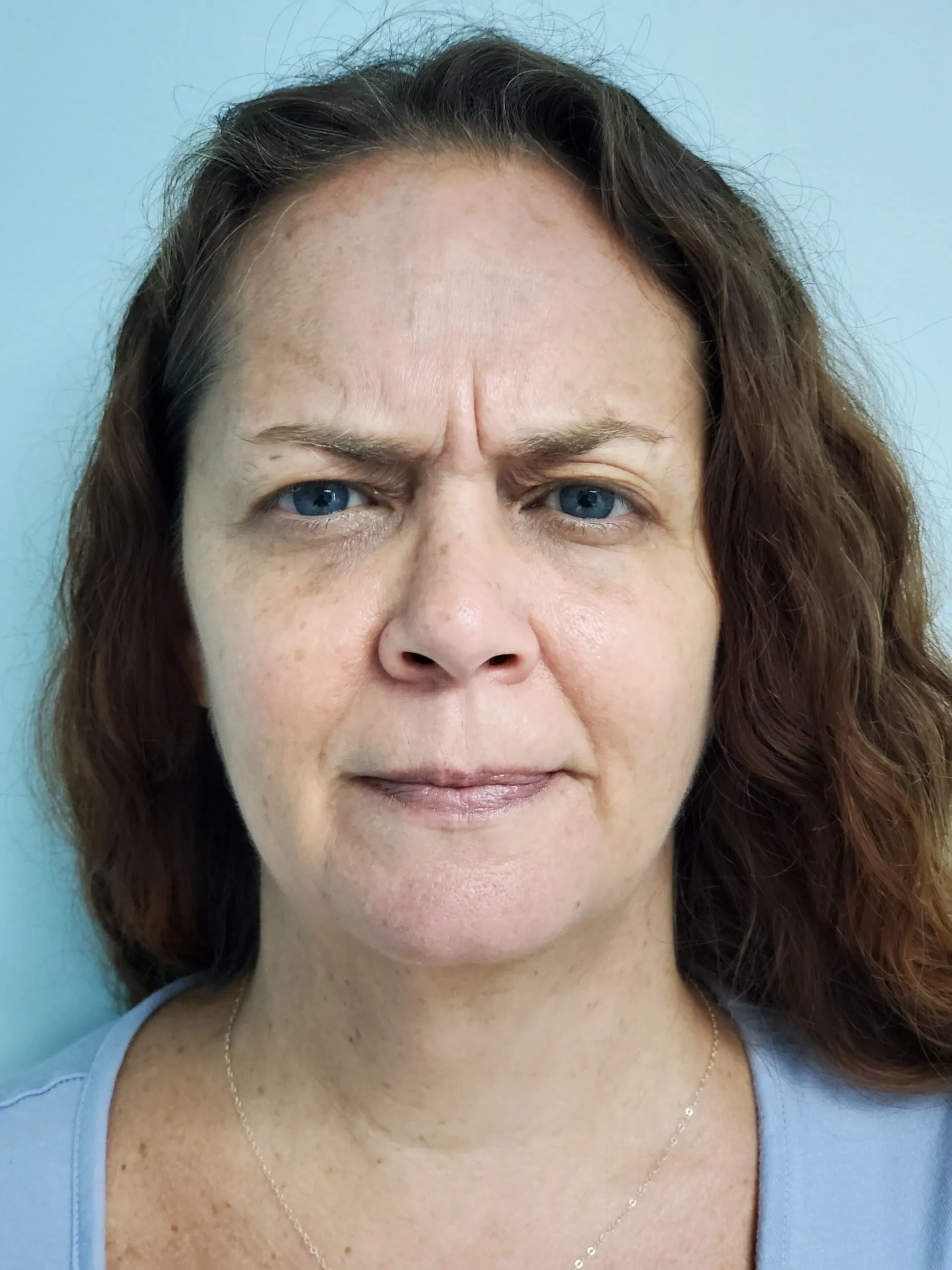 face-it-gallery-ba-carousel9b-scaled-1